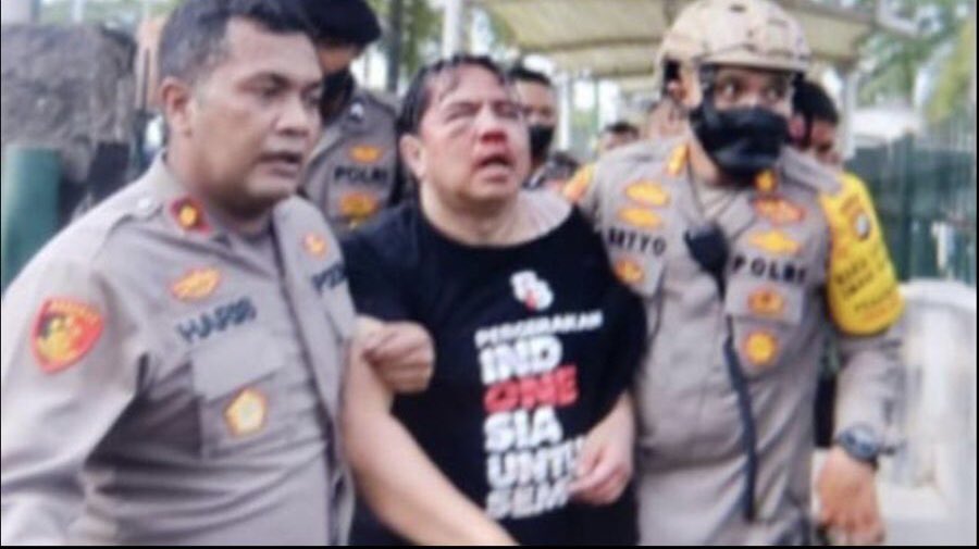 Ade Armando dipukuli &amp; ditelanjangi.
Kita tunggu tanggapan Lesti….