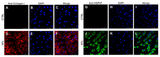 Biomed_MDPI's tweet photo. Check out 👉" Experimental Study on Blue Light Interaction with Human Keloid-Derived Fibroblasts"
See more at: https://t.co/FXd8ZmZWv2
#skinfibrosis #keloid #fibroblast #openaccess https://t.co/Bts5ihPvYG