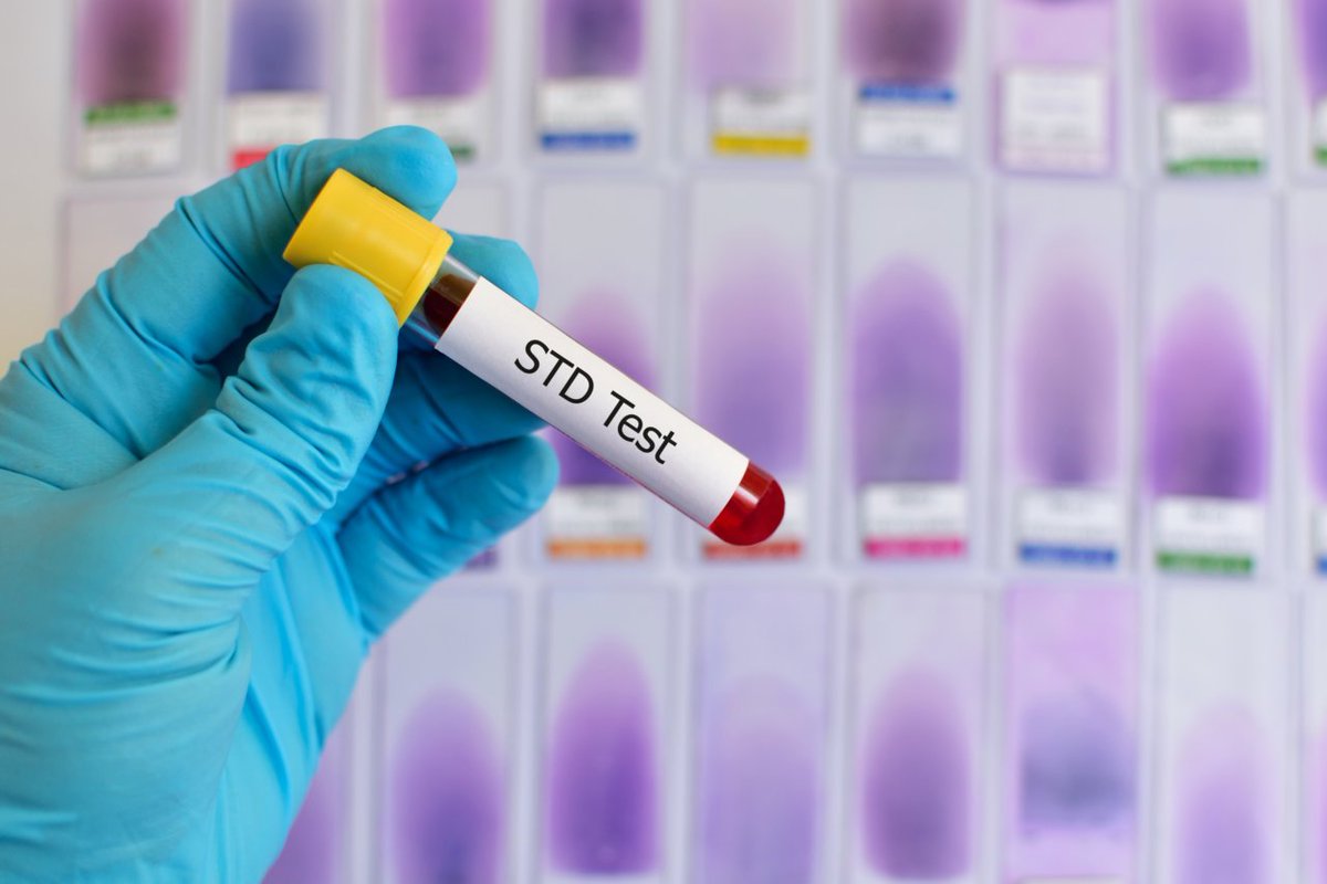 ValleyDx's tweet image. NEW BLOG: Why the STD epidemic requires a new approach to testing

🦠 STDs are on the rise, and quick and accurate detection is crucial. Lateral flow testing with data capture could hold the key.

#lateralflow #betterwithdata #STDawareness 

bondhealth.co.uk/blog/why-the-s…