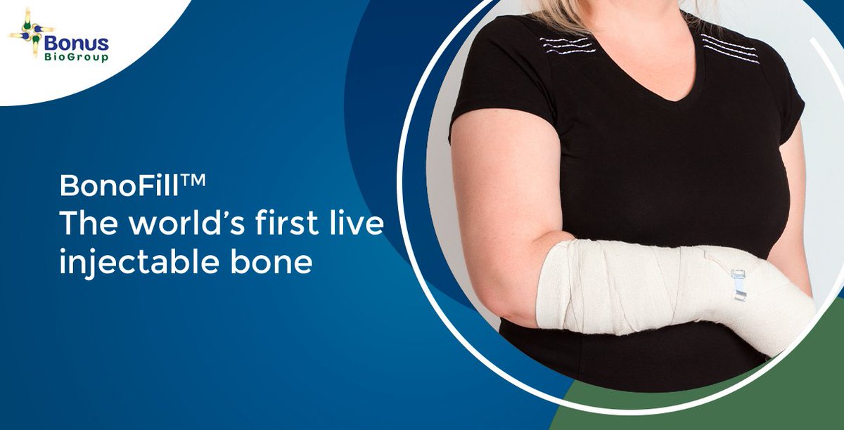 BBiogroup's tweet photo. Most bone loss is due to aging, so it makes sense that, as people live longer, the demand for #bonegrafts will increase. #BoneFill – our flagship investigational #tissueengineered bone graft, was demonstrated in dozens of patients to provide a safe and effective bone filling. https://t.co/93rVBVKcXo