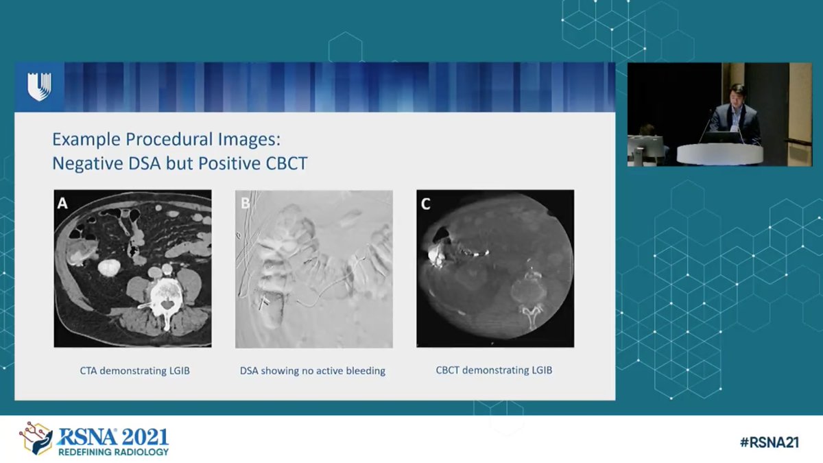 JonMartinMD's tweet image. Brushing up on abstracts for #RSNA22 and came across this gem from #RSNA21; star @DukeMedSchool  student @PungLeland presenting on the evolving use of CBCT for detection and treatment of GIB @DukeRadiology @DukeIR #RSNAmedicalstudentgrant
