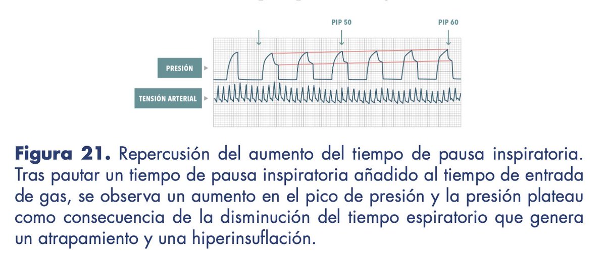 ventilacionmeca's tweet photo. En caso obstructivo también, efecto de la pausa inspiratoria.
#SoMe4M https://t.co/07VhtnysRx