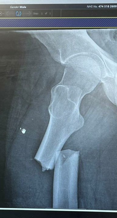 A quick update on Charlie's injury

He broke his femur
Went in for surgery today &amp; it has been successful

He's awake &amp; back to being Lord Banter in the WhatsApp group

Thank you to everyone for their well wishes &amp; kind words, they have been passed onto him

Get well soon big man