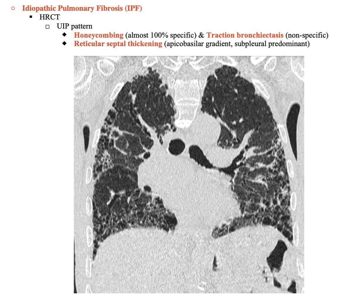ILD clues for the internist: here's a 🧵with some quick hits! Framework ...
