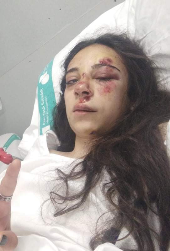 antiradarcatala's tweet photo. Ens demanen col-laboració per trobar testimonis d'un accident d'ahir a la nit a la C-58 a l'altura de l'IKEA de Badia del Vallès on un cotxe va impactar amb una moto tirant per terra a conductor i passatger sense aturar-se a socórrer. Si algú va veure alguna cosa comenteu-la. https://t.co/MDbr7XiSy7