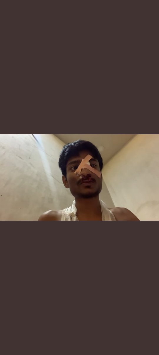 Being_ansari___'s tweet photo. @narendramodi @ArvindKejriwal @PunjabPoliceInd #justiceforparas 
I NEED A JUSTICE FOR PARAS BHAI https://t.co/ZOg7bleVJ5