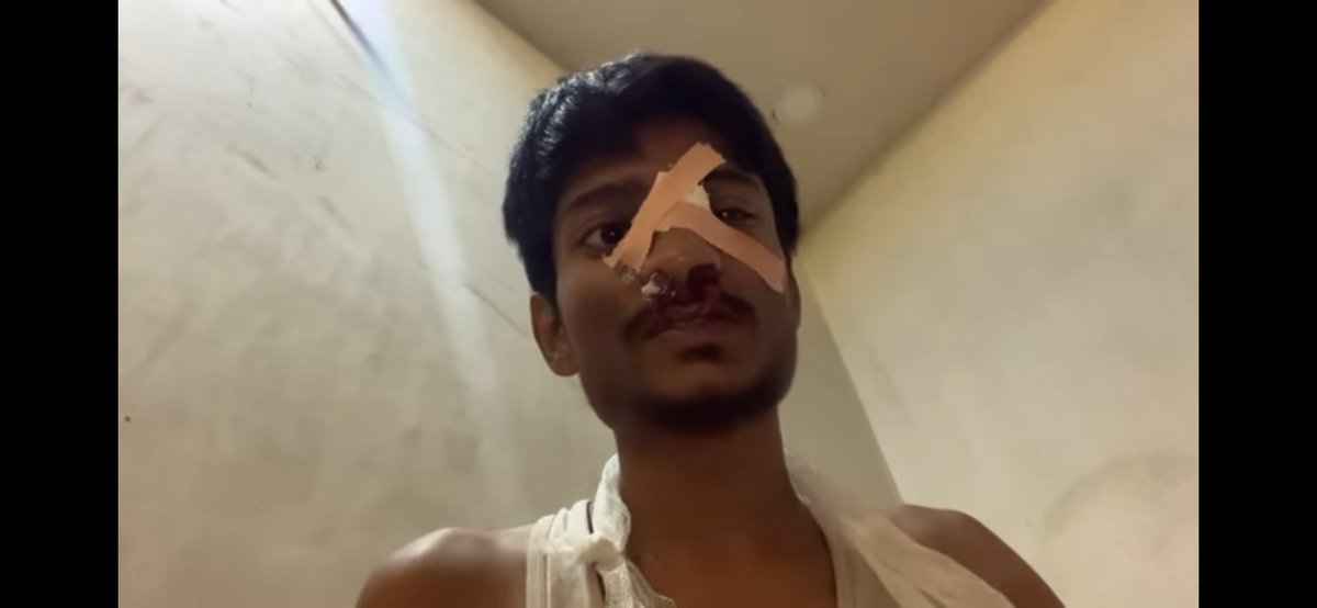 Kapilsingh_07's tweet photo. Help him plzzz plzz plz. @narendramodi @PMOIndia @ArvindKejriwal #ParasOfficial @PunjabGovtIndia @PunjabPoliceInd @CMOPb @AITC4Punjab @DGPPunjabPolice  #justiceforparasofficial https://t.co/8ZbwkxpydC