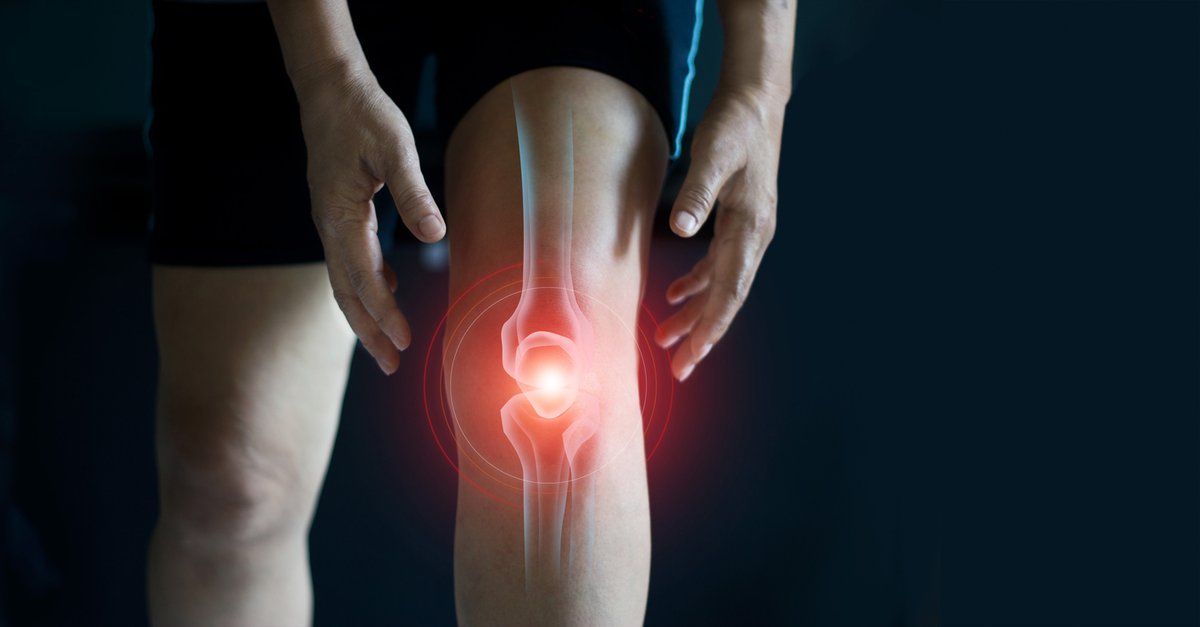 burgsimpson's tweet photo. Exactech Knee Devices Recalled Due To Increased Rates Of Failure And Need For Revision Surgery

Learn more about the Exactech recall here:
https://t.co/bEgfS5ptBg https://t.co/sdlaWAZGAw