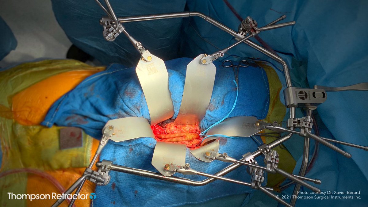 Thompson Retractor tweet media