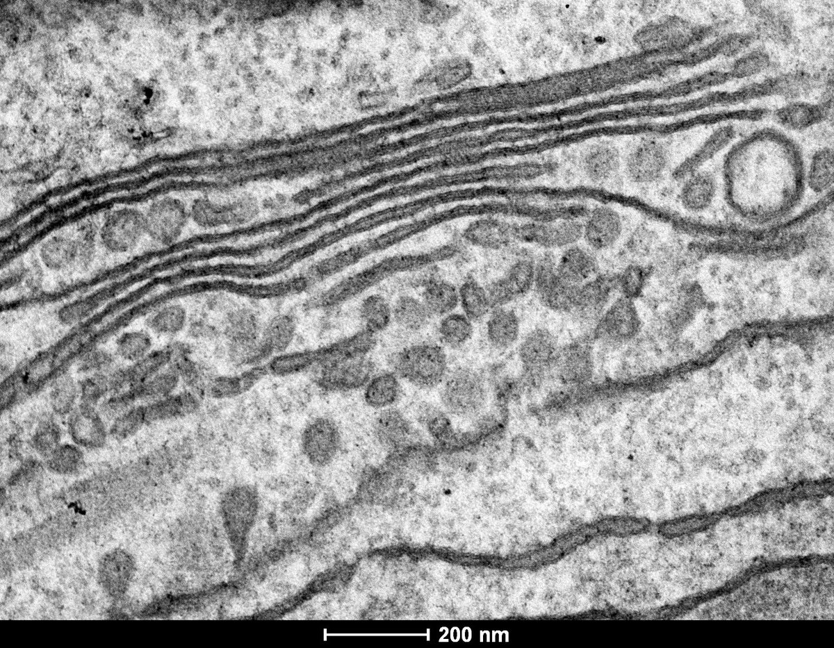 Electron microscopy of Golgi complex of the parasite Trichomonas vaginalis. In trichomonas, Golgi complex is associated with parabasal filaments (PF), forming parabasal apparatus, a defining feature of parabasalian Group. Vesicles budding of endoplasmic reticulum (ER) are seen