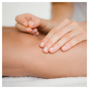 BodyTechPhysio's tweet image. Gunn IMS is needling technique that can help with myofascial or neuropathic chronic pain. This technique requires a detailed assessment to identify and target the correct areas.
bodytechphysio.wordpress.com
#kitchenerphysio