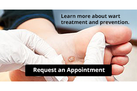 Plantar Warts Can Be Treated! dlvr.it/SNP2vd