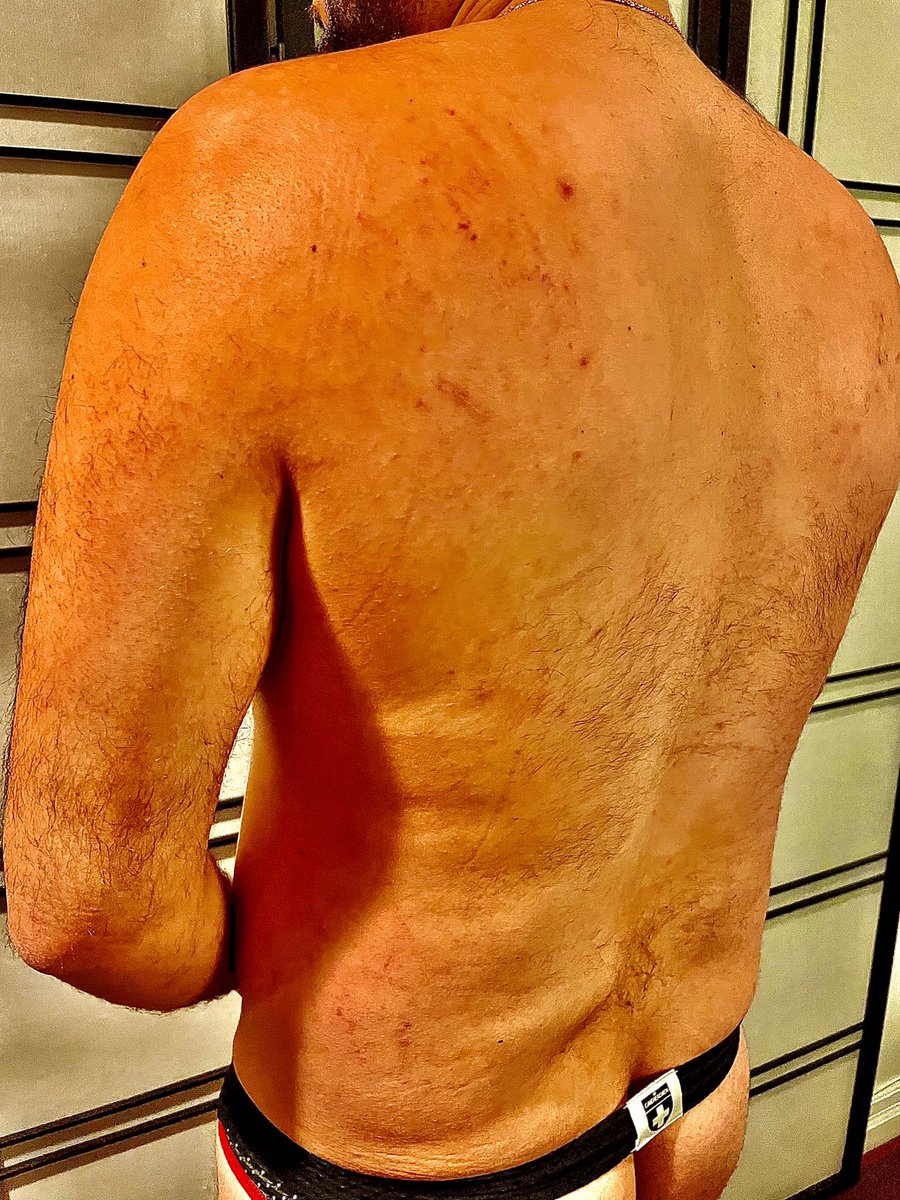 Service_Danimal's tweet photo. Attended my first ever Rough House🐶 Wish there was more space for play, wanted to come out looking more striped. 🐯🦓

#RoughHouse #torontokink #kink #gaysub #SubChaser #beautymarks #flogged #spaexcess #gaychaser #gaybear #bearsofinstagram 
#ThankGodThereWas1BearDom https://t.co/5xq7o0MLMM
