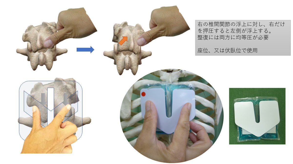 hydsupport's tweet photo. 上位頸椎の整復できない人がほとんどだと思います。非圧縮性流体圧で安全、確実に整復できるのが
メディカル・ハイドロバッグ整復法

https://t.co/Wb5OcAh7pq https://t.co/RnwgpJ3Z43