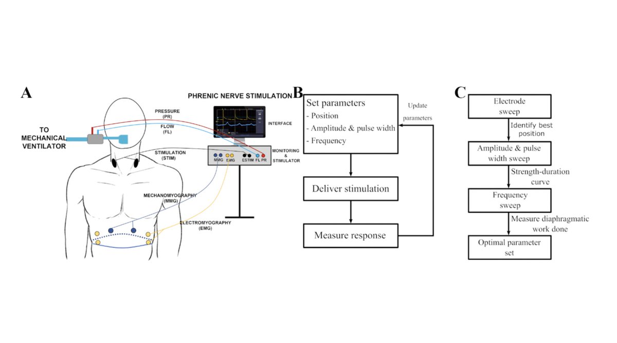 Artificial Organs (@artiforgans) on Twitter photo Non-invasive #PhrenicNerve #Stimulation to avoid #VentilatorInduced #DiaphragmDysfunction in #CriticalCare
#OnlineFirst👉bit.ly/3jyt1lq
@OxfordMedsci🇬🇧| @Udeconcepcion🇨🇱| <a href="/ConKeogh/">Conor Keogh</a> <a href="/Pablo_Aqueveque/">Pablo Aqueveque N.</a> #ElectricalStimulation Non-invasive #PhrenicNerve #Stimulation to avoid #VentilatorInduced #DiaphragmDysfunction in #CriticalCare
#OnlineFirst👉bit.ly/3jyt1lq
@OxfordMedsci🇬🇧| @Udeconcepcion🇨🇱| <a href="/ConKeogh/">Conor Keogh</a> <a href="/Pablo_Aqueveque/">Pablo Aqueveque N.</a> #ElectricalStimulation