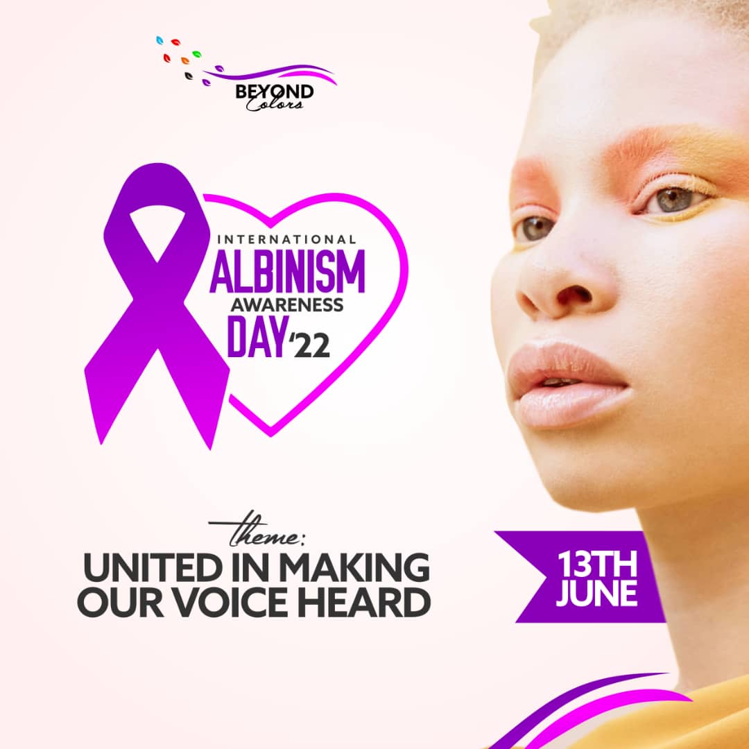 AyomideMatilda's tweet photo. All Of Us At Beyond Colors Foundation Are Pleased To Announce Our Full Participation In The Forthcoming International Albinism Awareness Day'22.
We Therefore Join The World In The Theme Announcement. "UNITED IN MAKING OUR VOICE HEARD"
June 13th Is The Date!
#beyondcolors https://t.co/dBMR6wducW