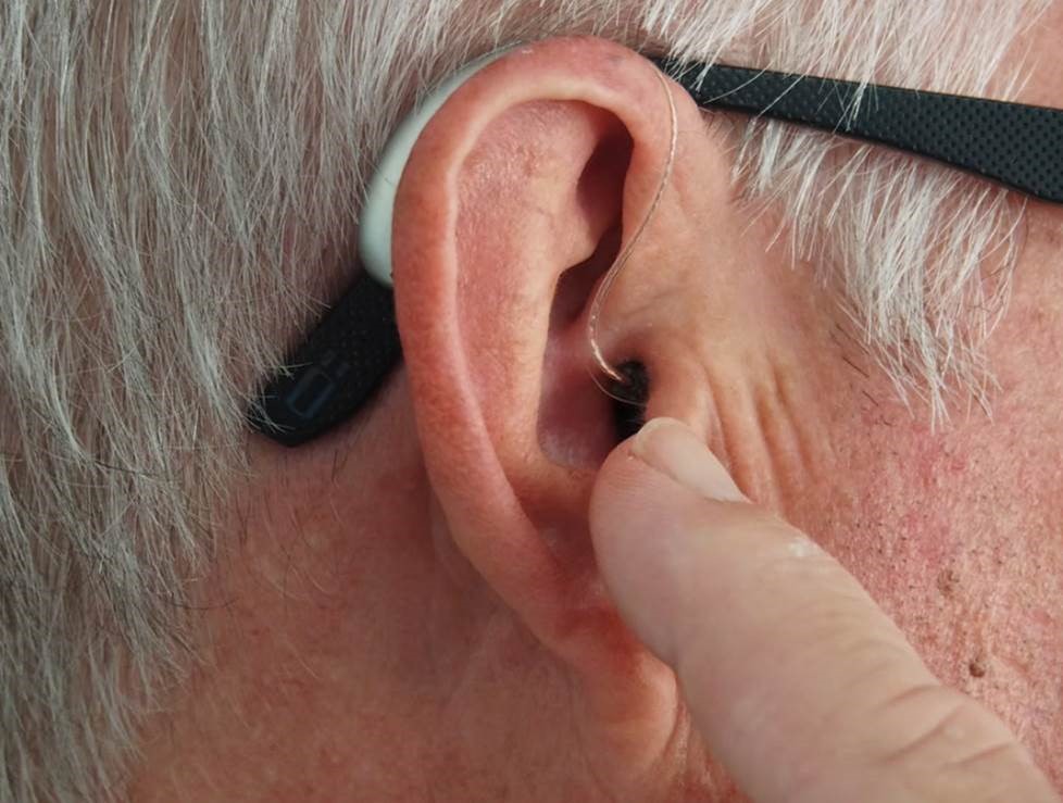 Around 11 million people in the UK have some type of hearing loss, making it the second most common disability in the UK.  Mr Ananth Vijendren, Consultant ENT Surgeon at Highgate Hospital answers Five things that you need to know about hearing loss bit.ly/3F1I2Wa