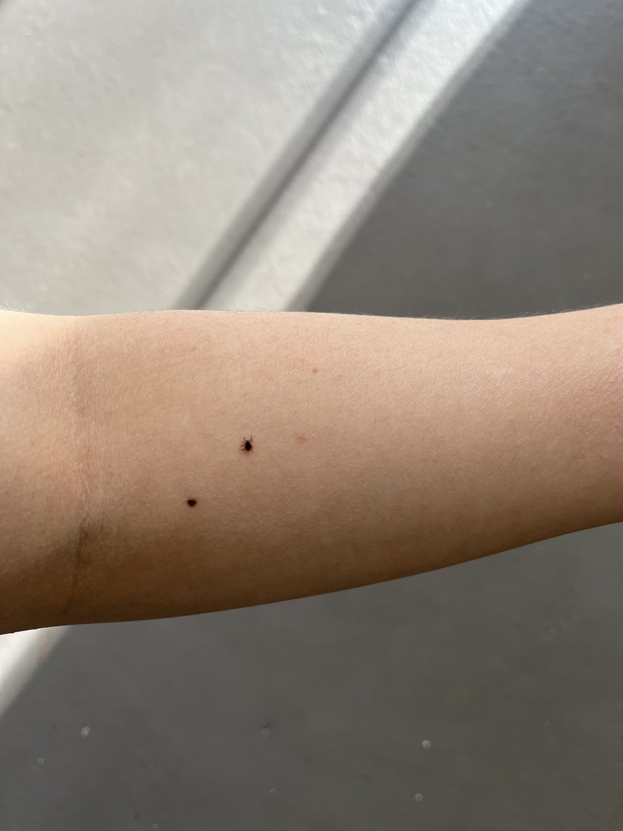 It's that time of year when our field scientists start memorizing where all their freckles are. That's because it's tick season. To learn more about ticks and preventative measures, visit: cdc.gov/ticks/avoid/on… 
#Normandeau #tickseason #tickprevention