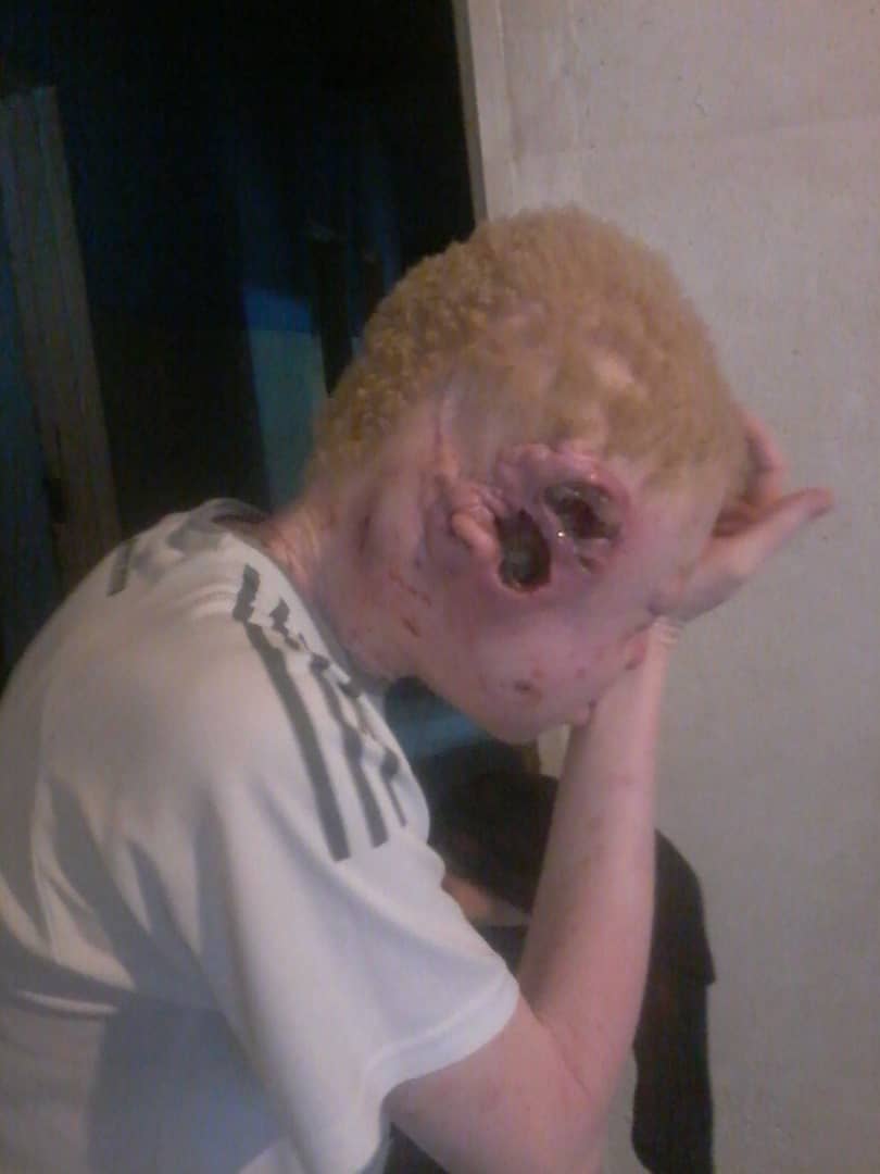 Queen of the North🇿🇼 tweet media