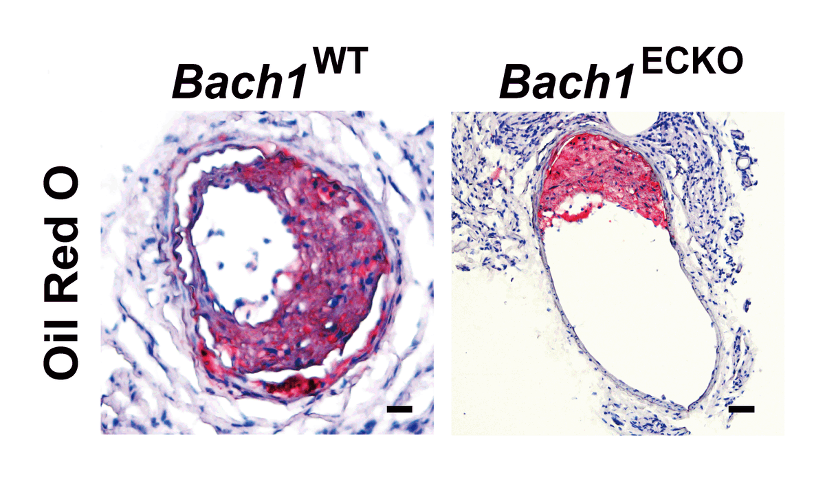 CircRes's tweet photo. Jia & colleagues identify BACH1 as a mechanosensory of hemodynamic stress and reveal that #BACH1-#YAP transcriptional network is essential to #vascular #inflammation and #atherogenesis. Learn more at https://t.co/Zy3QrD4eJK
@jingtdang @FudanUniv https://t.co/WxJxAihzMc