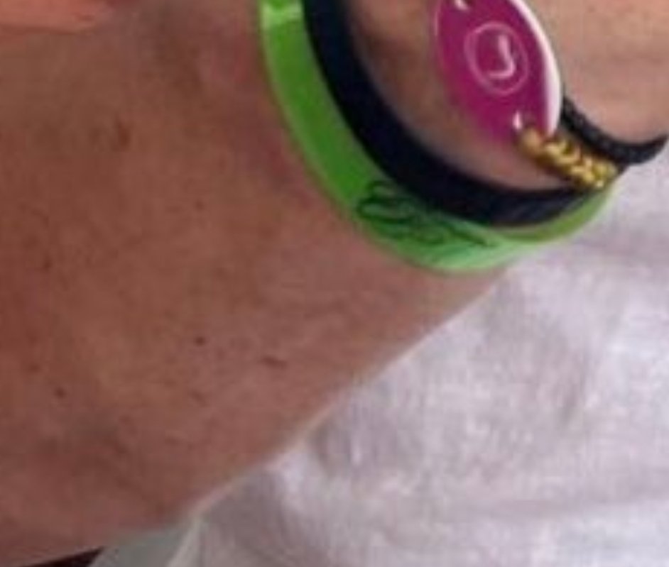 SkepticTrader7's tweet photo. @MrZackMorris Nah, he has more peach fuzz on his arms than you. https://t.co/ISd61viaMG