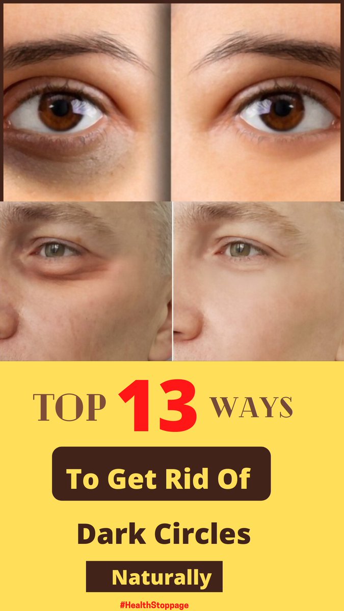 HealthStoppage's tweet photo. How to remove dark circles naturally t home https://t.co/djBgUZ6mq7

#DarkCircles #EyeBags #beauty #undereyecircles #skincare #lipfillers #healthstoppage #love #selfface #glowingski https://t.co/JaoxwSSFVq