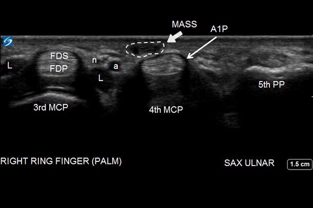 Erek Latzka MD, RMSK tweet media