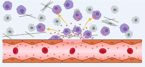 The Chan Lab (@thechanlab) on Twitter photo 🚨New paper alert! Study led by our PhD student Zachary found that tumour-associated macrophages transport and redistribute nanoparticles in tumours.👾
Check it out in <a href="/acsnano/">ACS Nano</a>!
📜:pubs.acs.org/doi/10.1021/ac…
<a href="/bme_uoft/">Biomedical Engineering @ University of Toronto</a> <a href="/DonnellyCentre/">Donnelly Centre</a> 🚨New paper alert! Study led by our PhD student Zachary found that tumour-associated macrophages transport and redistribute nanoparticles in tumours.👾
Check it out in <a href="/acsnano/">ACS Nano</a>!
📜:pubs.acs.org/doi/10.1021/ac…
<a href="/bme_uoft/">Biomedical Engineering @ University of Toronto</a> <a href="/DonnellyCentre/">Donnelly Centre</a>