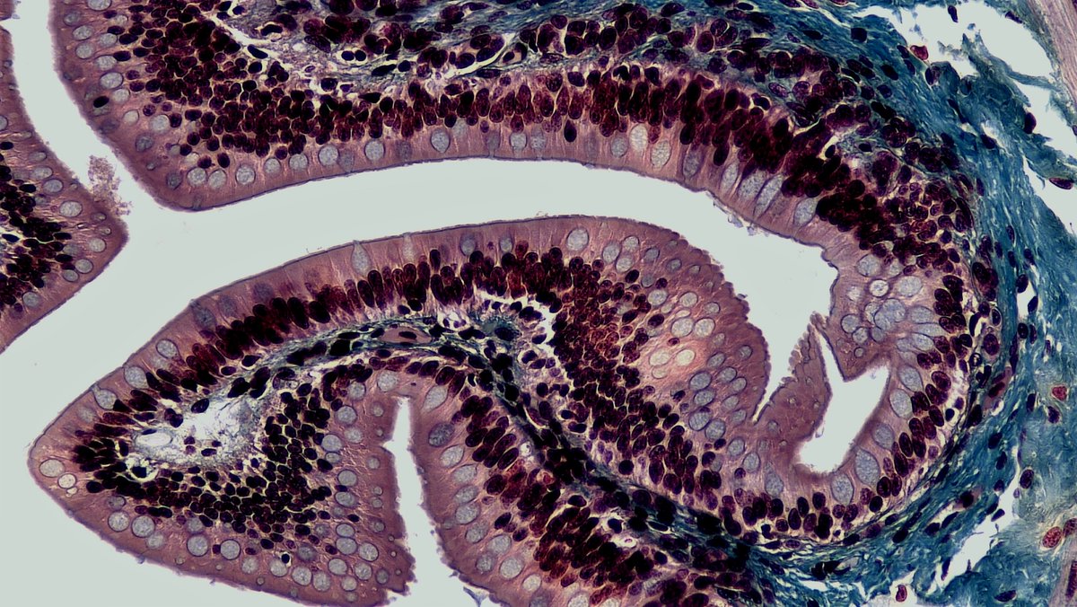 organoidscience's tweet photo. 🧪 @ClemsonUniv scientists used #SmallIntestinal organoids to assess if #arsenic exposure would impair intestinal stem cell differentiation and found it impaired intestinal trophocytes and telocytes, leading to alterations in the Bmp signaling pathway.
https://t.co/s4qgxIIQFy https://t.co/GSwATplBIR