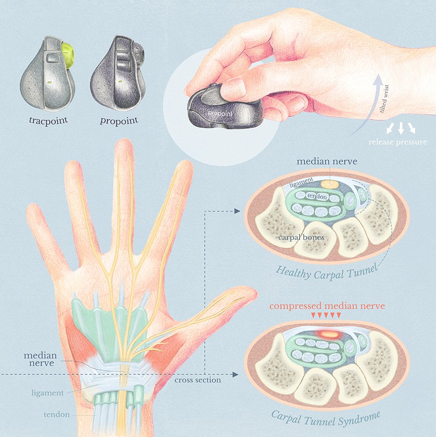 emmacreats's tweet photo. An artwork I did for a Carpal Tunnel Sydorme relief mouse.
#art #illustration #healthcare https://t.co/xrMWA9kd3t