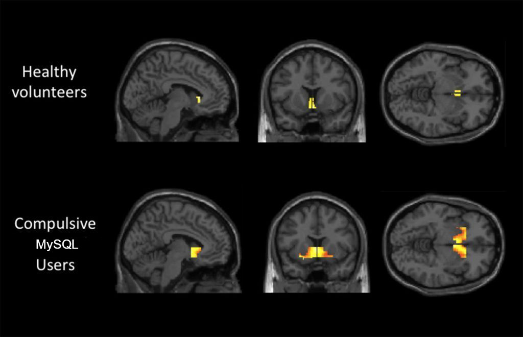 IBM_Db2luw_memes tweet media