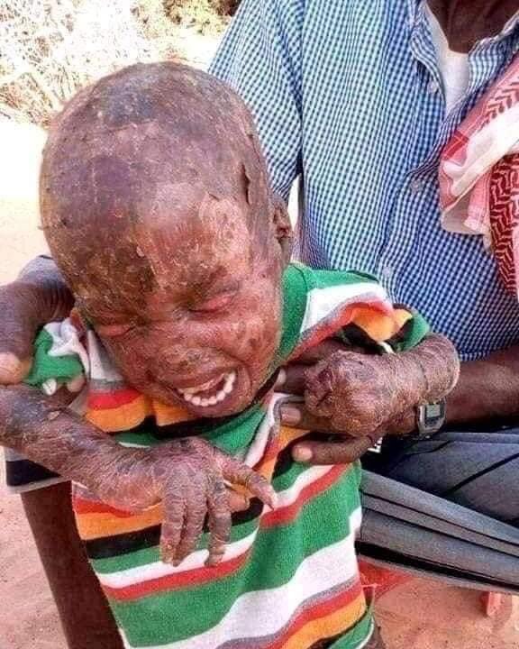 DongoloLoubak's tweet photo. “International Community” #UN, #US, #UK, #EU, #Canada &amp; “Humanitarian stakeholders” #WFP, #USaid… MUST stop patronising #Afar. All options are NOT on the table due to lack of nuclear one. The only option for #HumanitarianTruce = zero #TPLFTerroristGroup #Afar land occupation. https://t.co/bfvbVJIRji