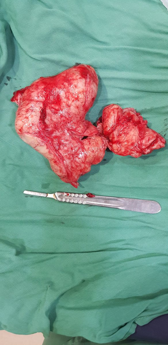 Bismillaah... Bila bapak atau kakek kita divonis BPH (pembesaran