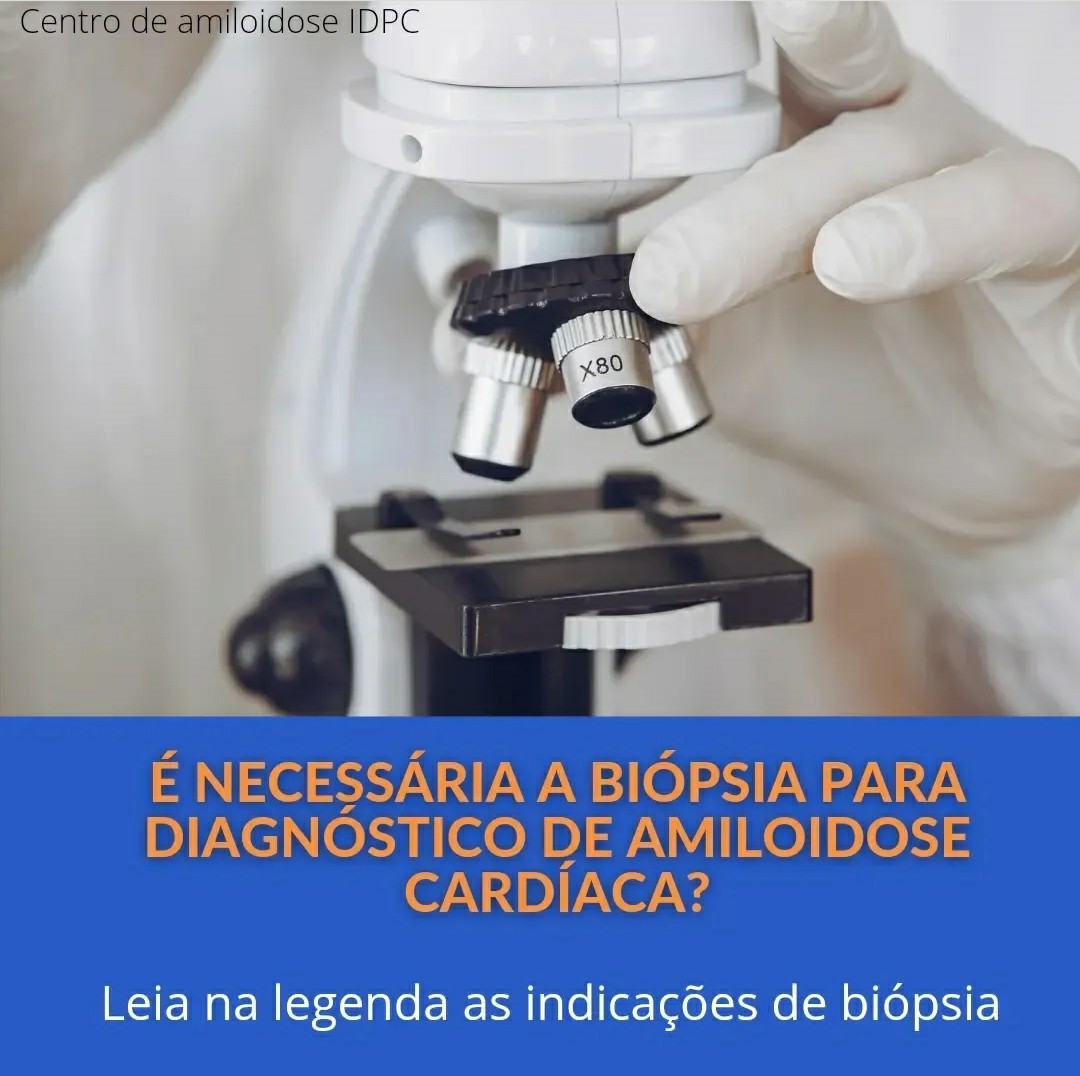 amiloidosedante's tweet photo. ⁉️Depende, é a resposta correta à essa pergunta! Veja no link abaixo.
https://t.co/djXWbtoY6K https://t.co/oYJcypwntx