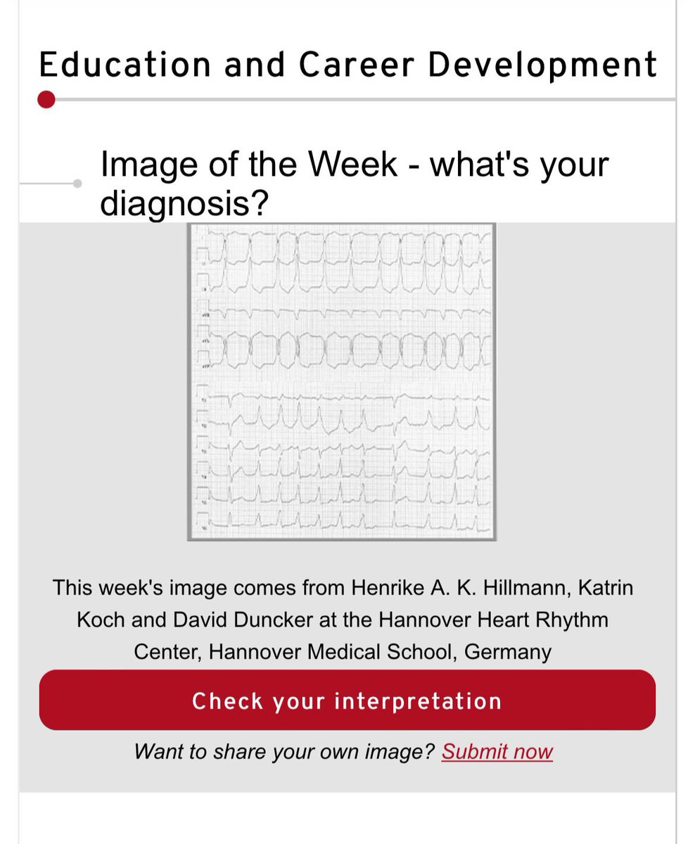 #EPeeps check out the new #imageoftheweek within this week’s ESC News - ideas? 🤓 escardio.org/Education/Imag…
