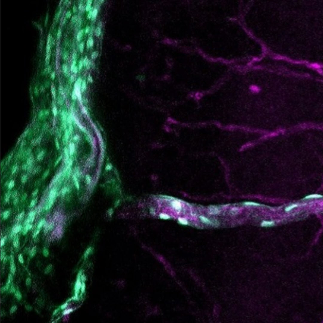 #Fibroblasts in the #brain—what do they do? Learn about the latest #microscopy advances by @SiegenthalerLab: spie.org/news/taking-a-…

#OpenAccess #Neurophotonics #Neuroscience #WomenInOptics