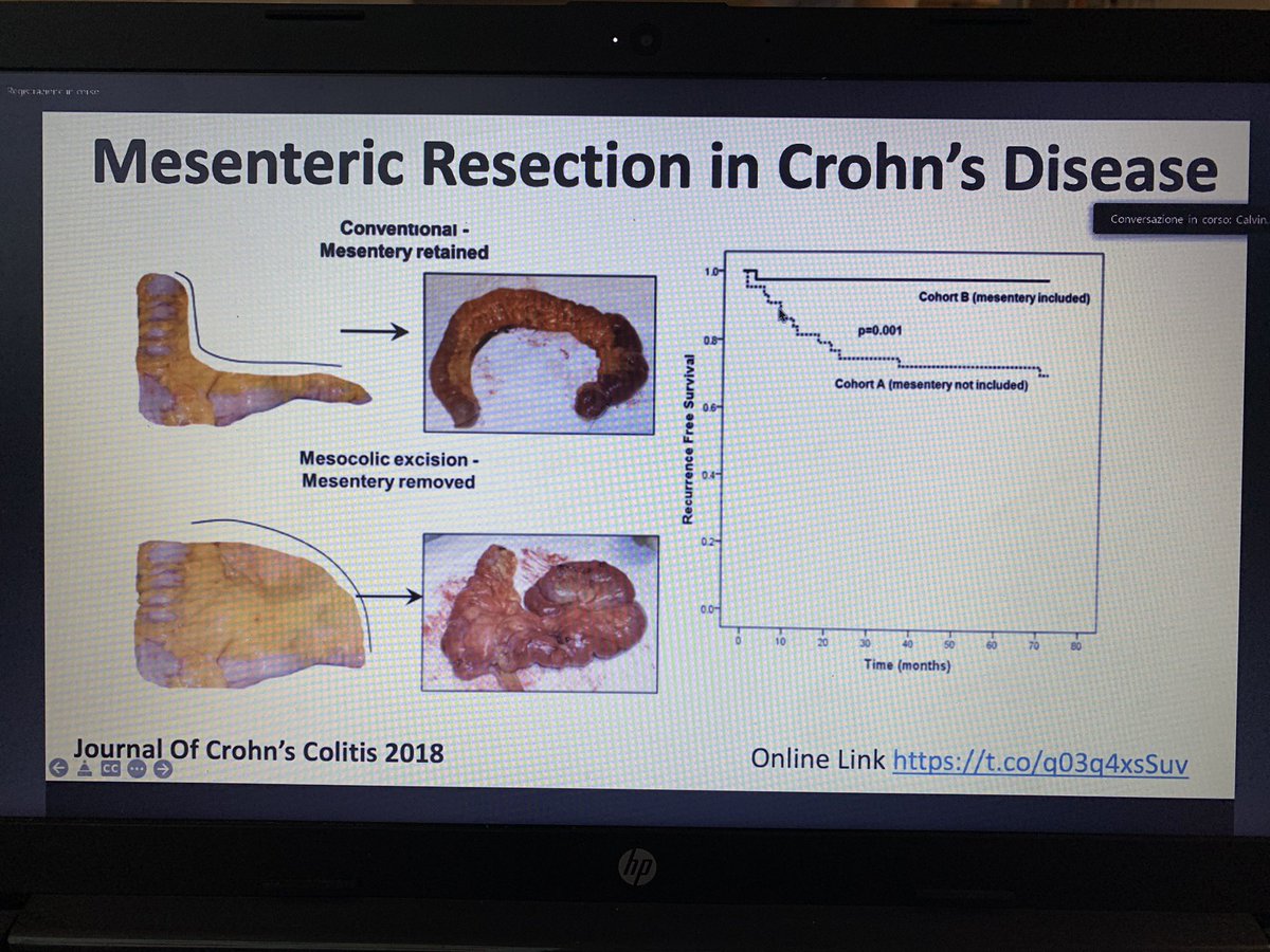 ugolinimd's tweet photo. Outstanding presentation at Ravenna surgical Grand Round by dr Coffey on the role of mesentery in Crohn’s disease https://t.co/jekItQUFGR