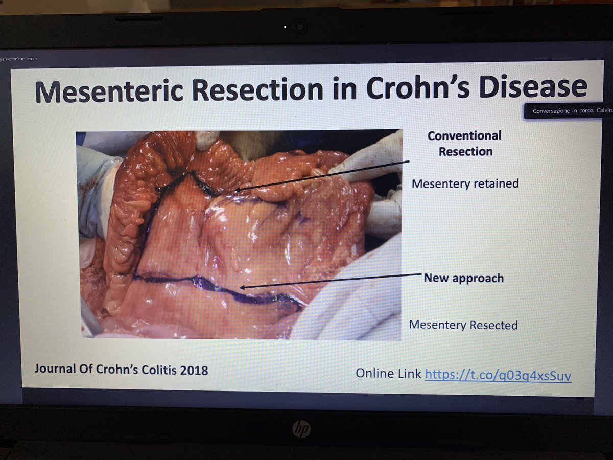 ugolinimd's tweet photo. Outstanding presentation at Ravenna surgical Grand Round by dr Coffey on the role of mesentery in Crohn’s disease https://t.co/jekItQUFGR