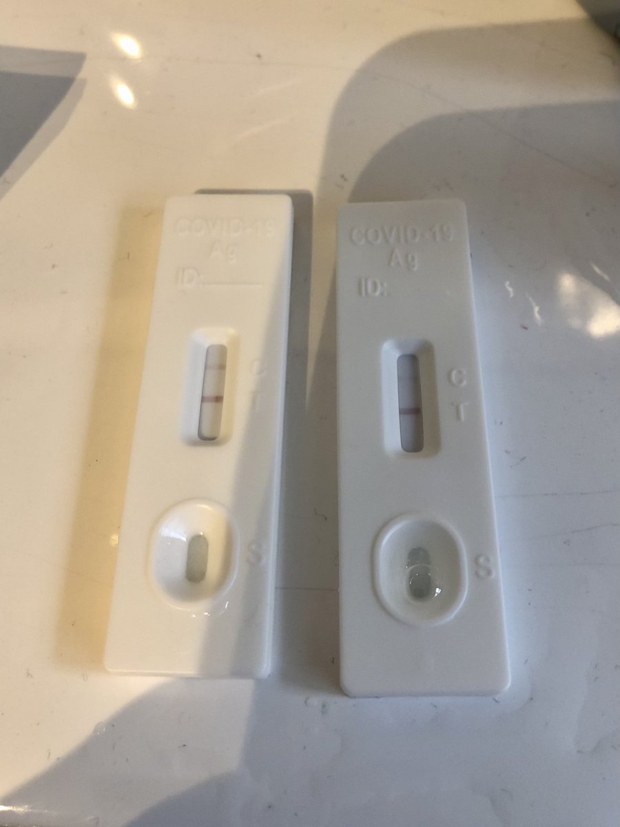 NicolaiD's tweet photo. Here we Go. 6 Monate Notaufnahme, letzte Woche Coronastation „geschmissen“. Ich hatte eigentlich schon früher damit gerechnet… #Medizinbrennt #medizin #Assistenzarzt #innere #zna https://t.co/WJWv3ABzuY