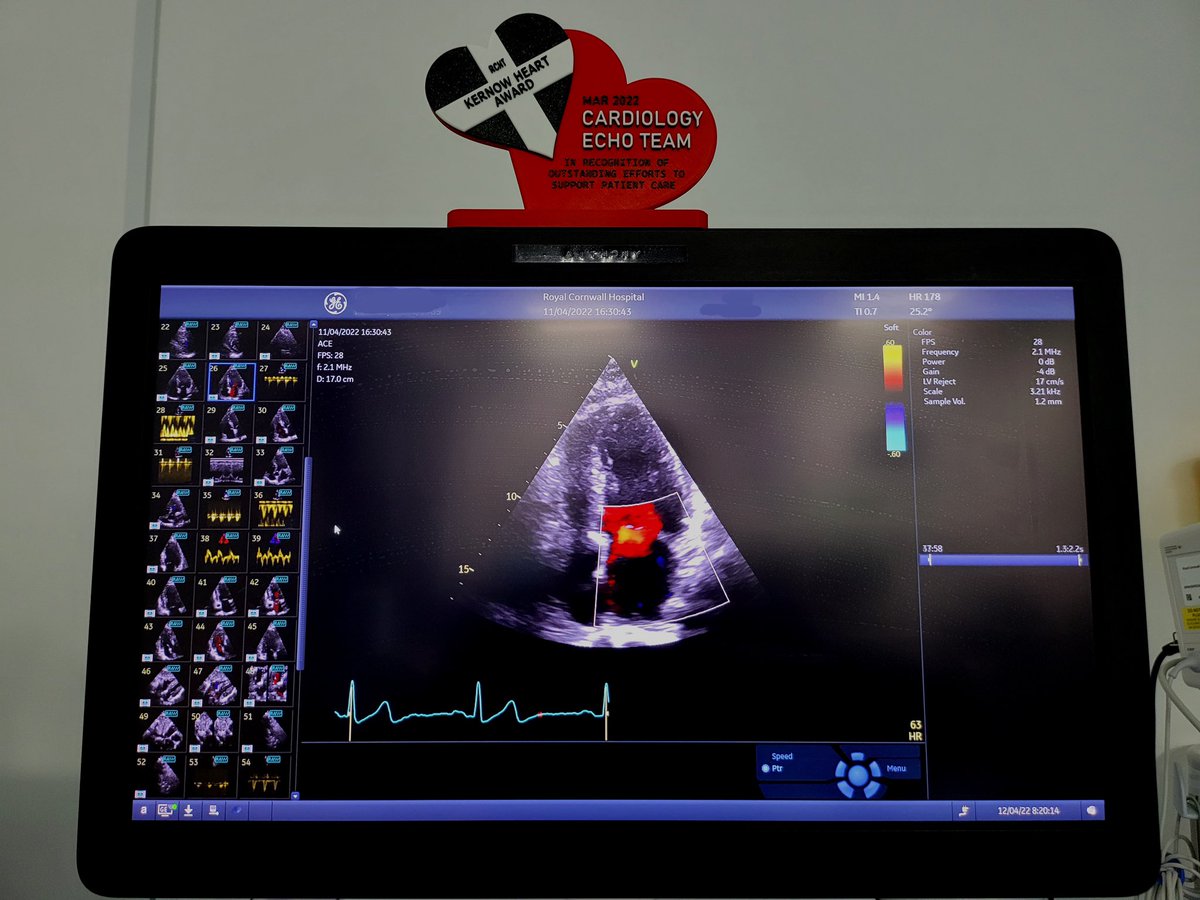 RCHT Cardiac Department (@cardiacrcht) on Twitter photo Congratulations to <a href="/Helzie78/">Helen Roberts</a> and our Echo Team for winning the Kernow Heart Award in recognition of outstanding efforts to support patient care 😀 Congratulations to <a href="/Helzie78/">Helen Roberts</a> and our Echo Team for winning the Kernow Heart Award in recognition of outstanding efforts to support patient care 😀