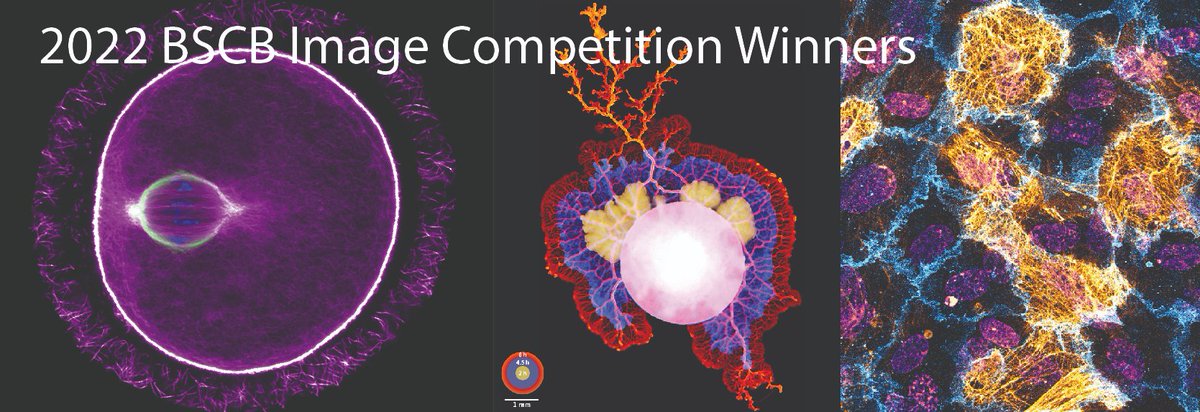 In case you missed the announcement at our annual conference last week <a href="/Official_BSCB/">BSCB</a> is pleased to announce the winners of our 2022 Image competition:

1st place: @F_Mikus from <a href="/EMBLHeidelberg/">EMBL Heidelberg</a> 
2nd place: <a href="/Sam__Dunkley/">Sam Dunkley</a> from <a href="/BristolUni/">University of Bristol</a>
3rd place: Tom Mitchell from <a href="/QMUL/">Queen Mary University of London</a>