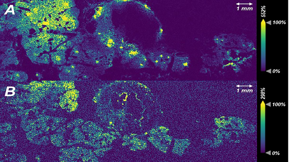 Human BioMolecular Atlas Program (HuBMAP) (@_hubmap) on Twitter photo Here, <a href="/_hubmap/">Human BioMolecular Atlas Program (HuBMAP)</a> researcher Kevin Zemaitis of <a href="/PNNLab/">Pacific Northwest National Laboratory</a> shows MALDI <a href="/imaging_ms/">MS_Imaging</a> of human pancreas, highlighting the location insulin and two different proteoforms of histone H4. Image of the Week is here to break things down and make things easy to digest like a pancreatic enzyme! Here, <a href="/_hubmap/">Human BioMolecular Atlas Program (HuBMAP)</a> researcher Kevin Zemaitis of <a href="/PNNLab/">Pacific Northwest National Laboratory</a> shows MALDI <a href="/imaging_ms/">MS_Imaging</a> of human pancreas, highlighting the location insulin and two different proteoforms of histone H4. Image of the Week is here to break things down and make things easy to digest like a pancreatic enzyme!