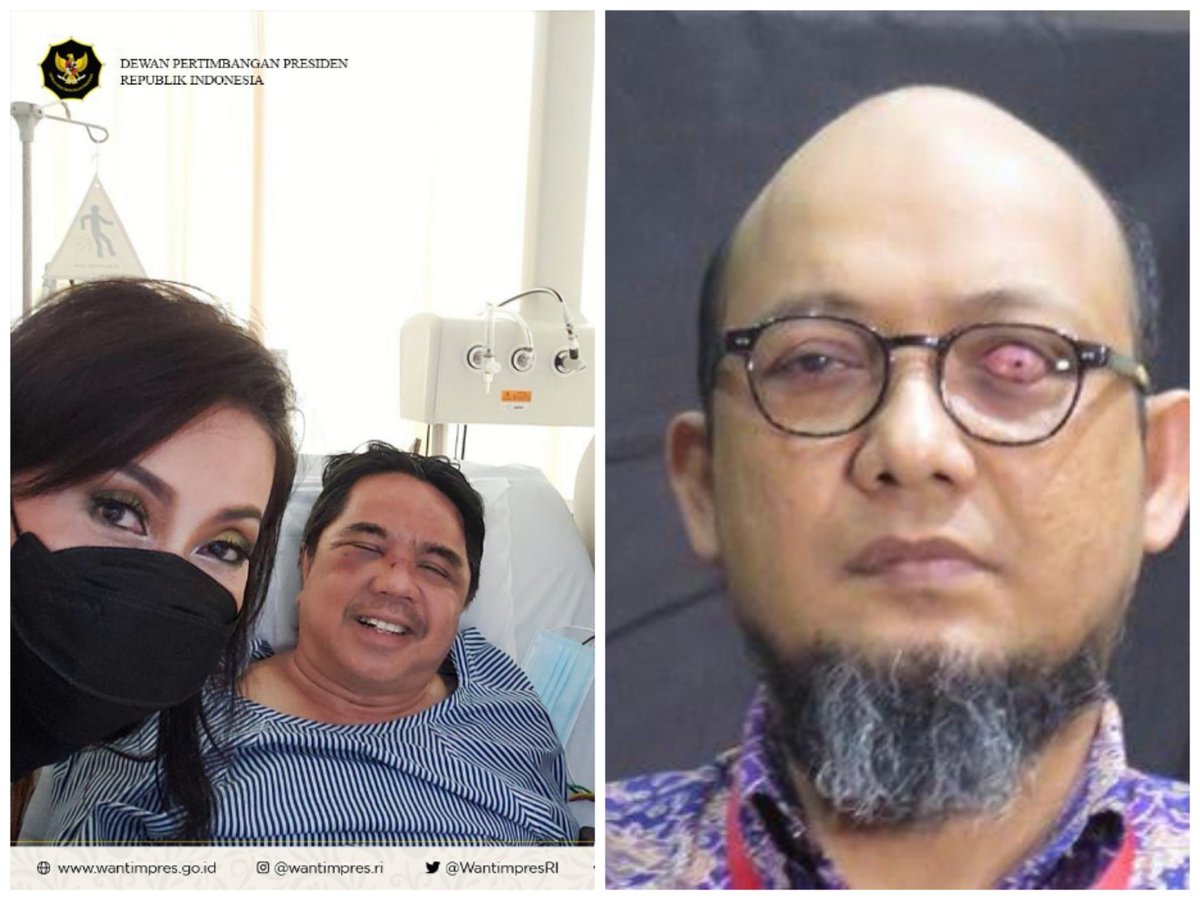 Novel Baswedan kehilangan satu matanya, cacat seumur hidup malah dipecat.. gak ada pejabat yg peduli

Ade Armando yg cuma buzzer, diamuk masa krn bikin konten.. seisi istana mengecam bahkan dijenguk Watimpres Jokowi

SILAHKAN RAKYAT MENILAI!!