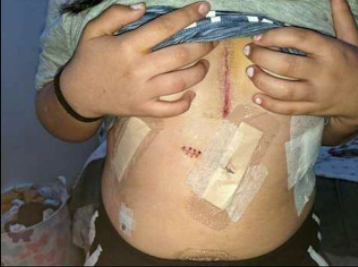 LAPPL's tweet photo. The result of Gascon’s sentencing policies. Juvenile suspect stabbed 13-yr-old 3 times, puncturing the liver, kidneys, diaphragm and pericardial sac. Result: probation. 
https://t.co/tI2ooJHAO2 https://t.co/YNfnz0eUjK