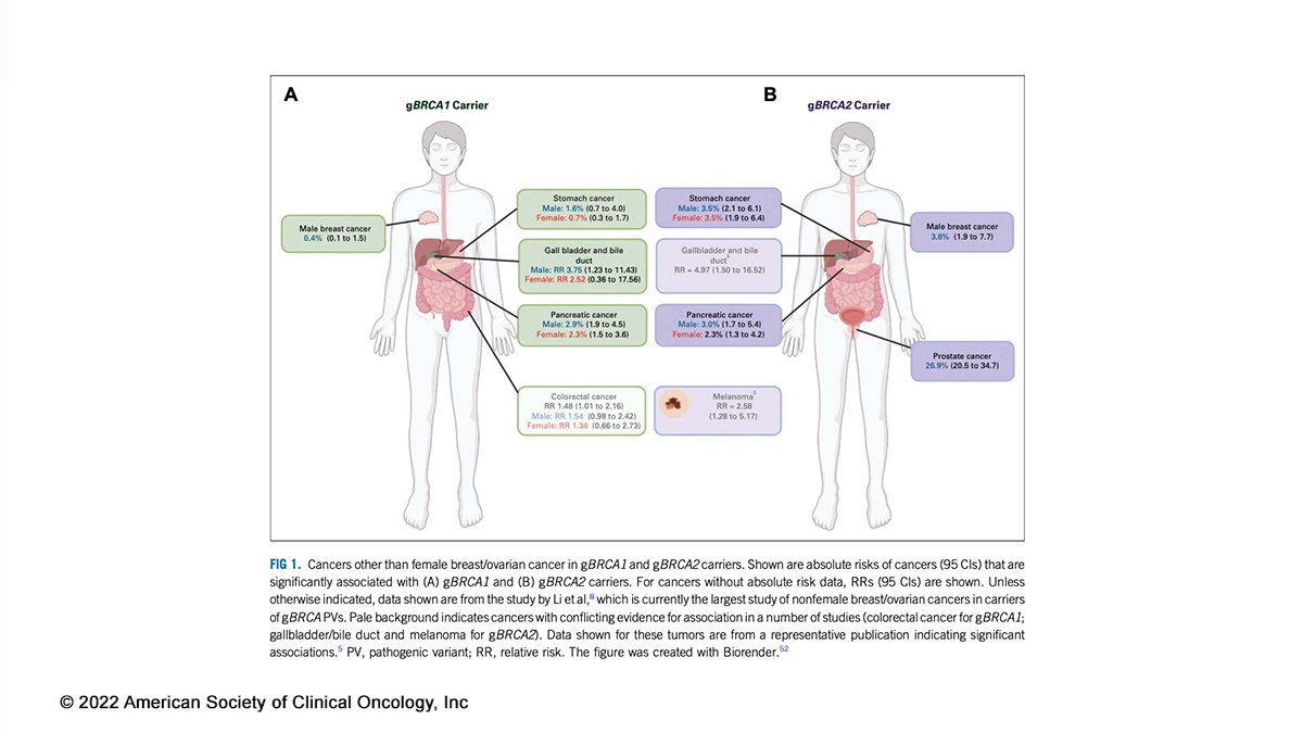JCO_ASCO's tweet photo. 🧐  #JCO #UnderstandingThePathway: Germline Pathogenic Variants in #BRCA1 and #BRCA2: Malignancies Beyond Female #BreastCancer and #OvarianCancer https://t.co/iuSwiH3WxB #gyncsm #BCSM #pancsm #PCSM https://t.co/rGBhQjGUCT