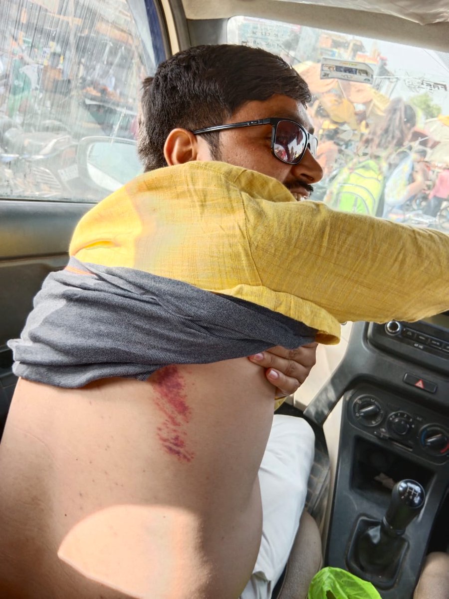 BJYMRJ's tweet photo. इस लाठी की मार का जवाब सही तरीके से दिया जाएगा गहलोत जी।

#ChaloKaurali 

@Tejasvi_Surya @DrSatishPoonia @HimanshuSBJYM https://t.co/pZUlxcsCwO