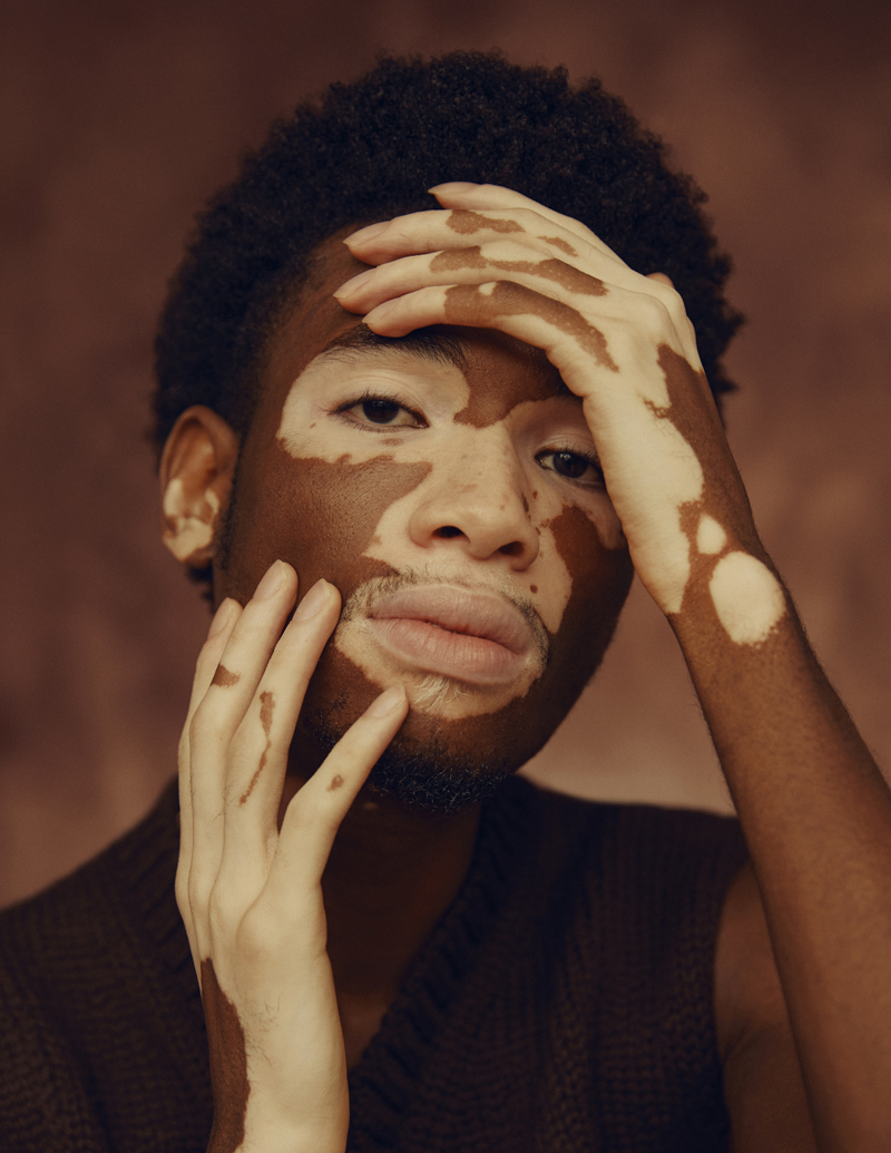 Yvesmark Chery shot by me 🤎