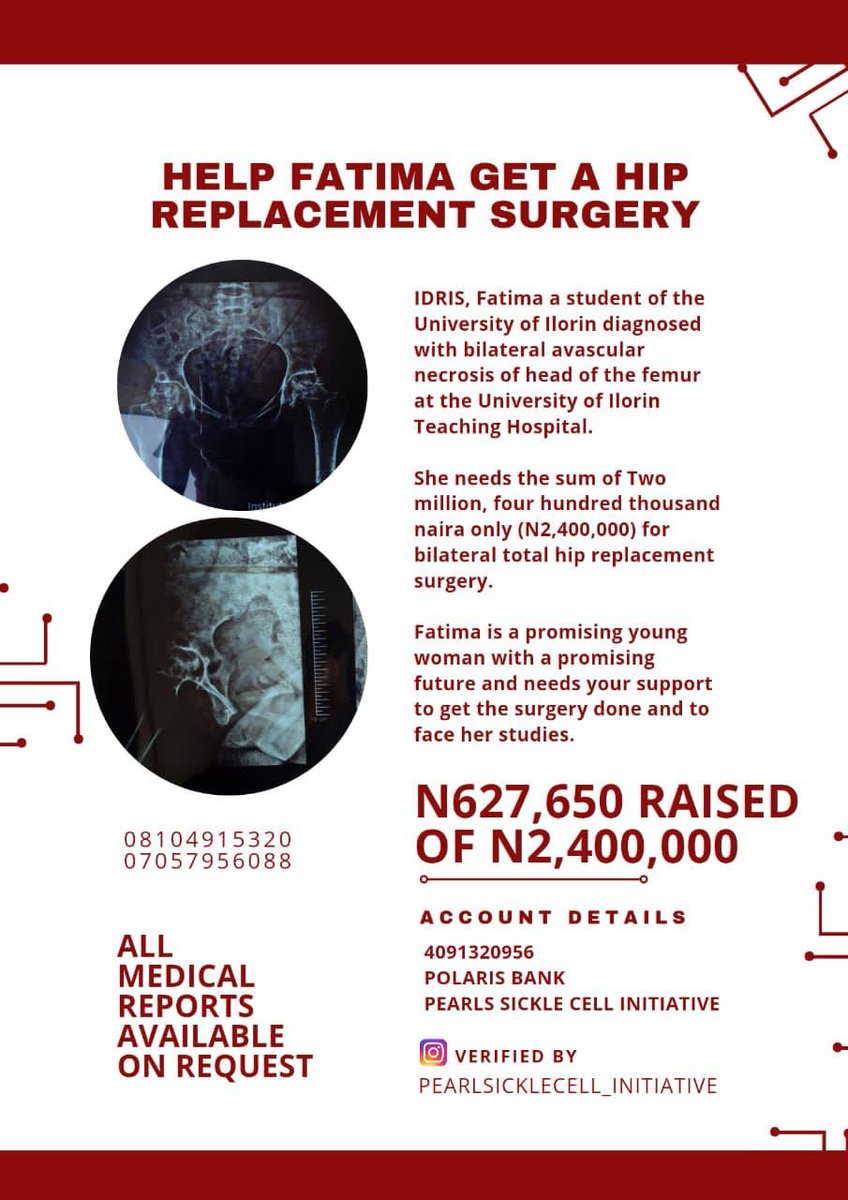 kingannicus's tweet photo. Thank you guys, we are making progress. Let's keep retweeting and donating to save Fatima.
@cuppymusic @TeniEntertainer @davido
#saveFatimah
#HelpFatima https://t.co/aGd2omorEh