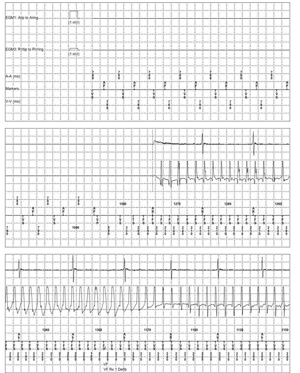 Hakeem Ayinde tweet media