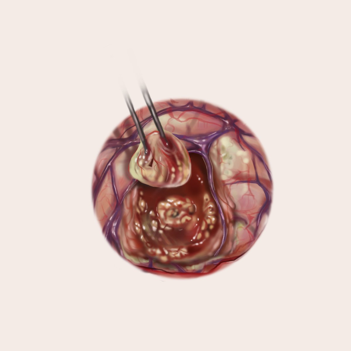 illustrallison's tweet photo. #PortfolioDay Hello! I am a medical illustrator in Chicago🫀 I like to work in 2D and 3D! 

💌 https://t.co/h781HuKUhm https://t.co/56in4RBGsT